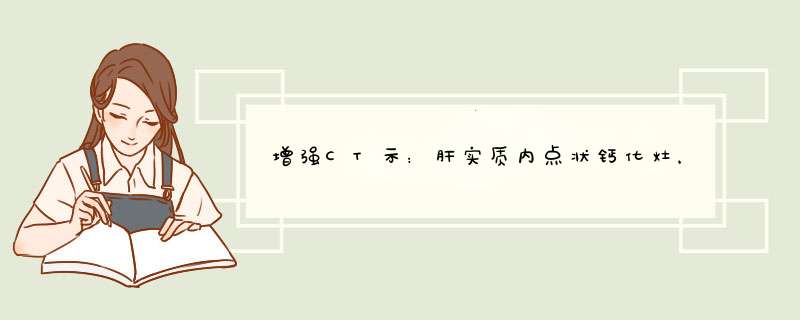 增强CT示：肝实质内点状钙化灶，左肾上腺内支稍增粗。胆囊窝区短条状高密度影，左肾实质小囊性占位，请解答,第1张